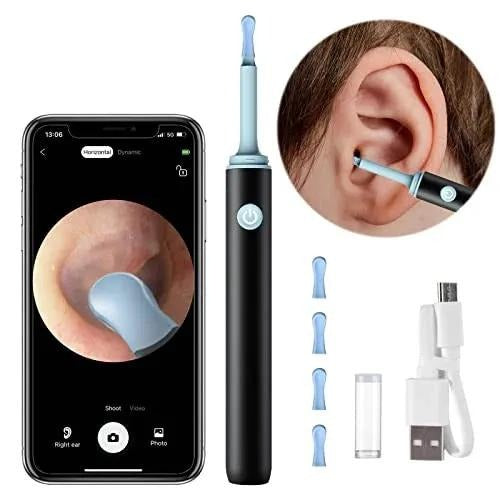 Smart Ear Cleaner with Camera and LED Light – Wireless Ear Wax Removal Tool with High Precision Cleaning Kit