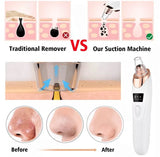 5 In 1 Blackhead Remover Machine – Rechargeable Face Vacuum Suction Tool with 5 Interchangeable Heads