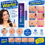 Wart Remover Gel Pen – Powerful Wart Removal Treatment for Hands, Feet & Skin | Wart Care Ointment for Common Warts | Easy Apply Skin Treatment