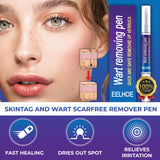 Wart Remover Gel Pen – Powerful Wart Removal Treatment for Hands, Feet & Skin | Wart Care Ointment for Common Warts | Easy Apply Skin Treatment